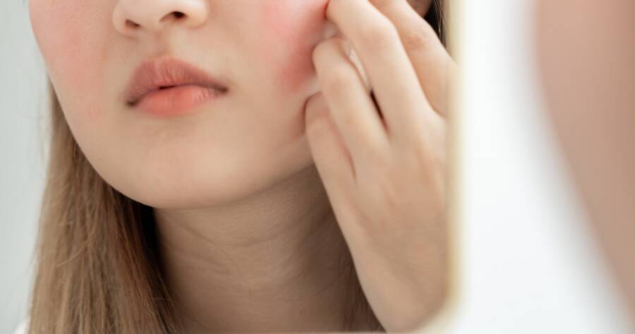 Barrier Repair 101: How to Fix Over-Exfoliated, Sensitized Skin